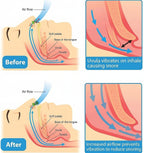 Anti Snoring Nose Clip