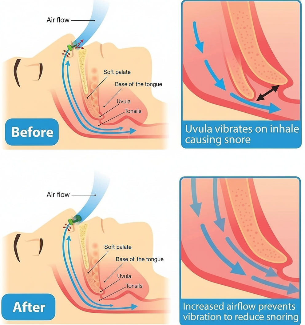 Anti Snoring Nose Clip